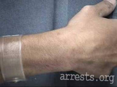 Brandon Brecht  Arrest Photo